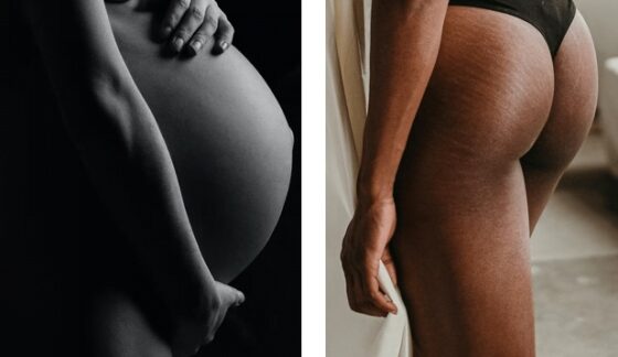 grossesse soins post