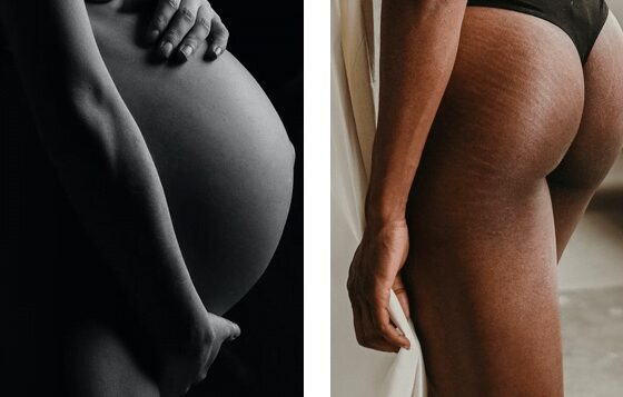 grossesse soins post