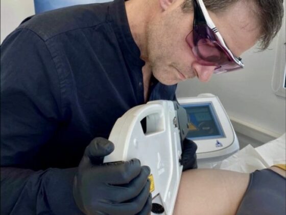 RECOSMA VERGETURE LASER