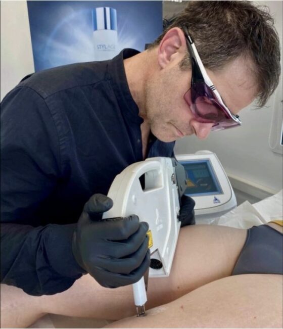 RECOSMA VERGETURE LASER