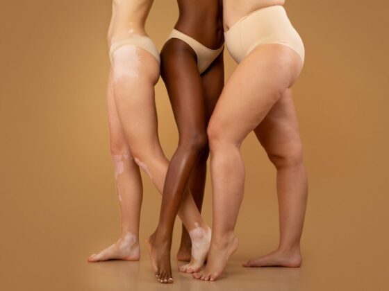 PERDRE DU POIDS traitement