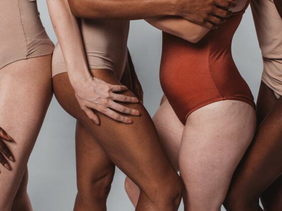 celulite traitement efficace medecine esthetique